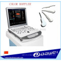 Equipo portátil de Doppler vascular y máquina de ultrasonido portátil